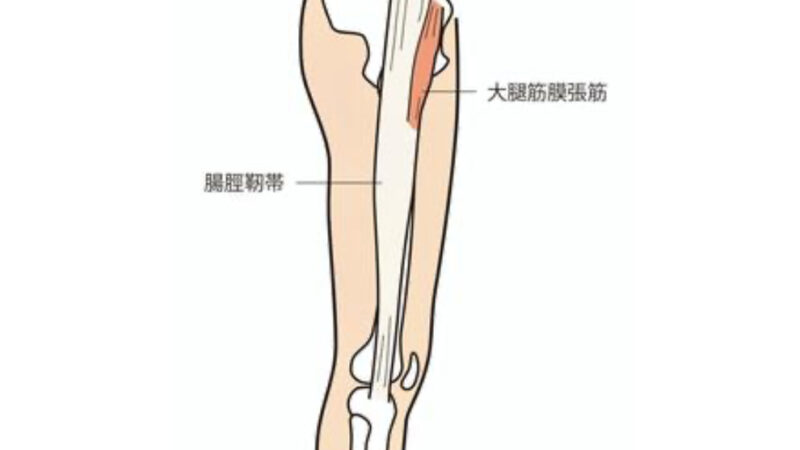 腸脛靭帯炎