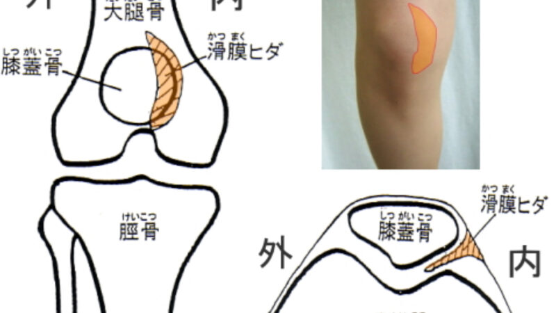 膝の痛み〜タナ障害〜