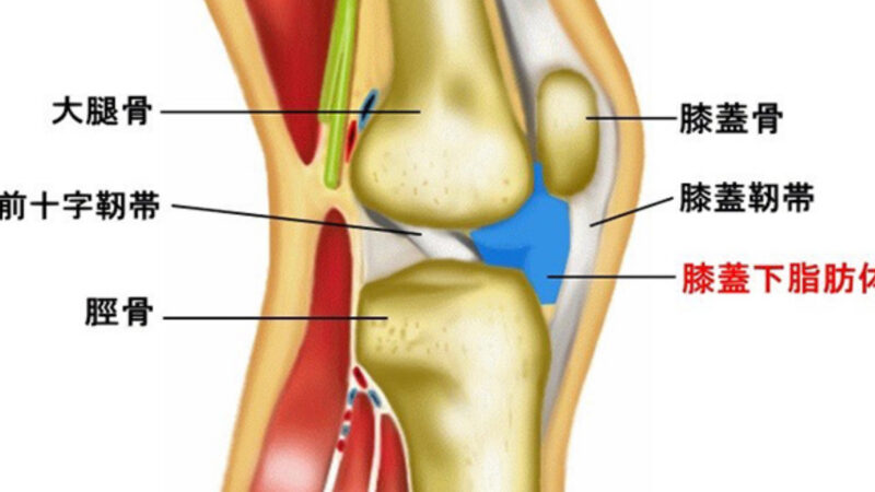 膝蓋下脂肪体炎とは